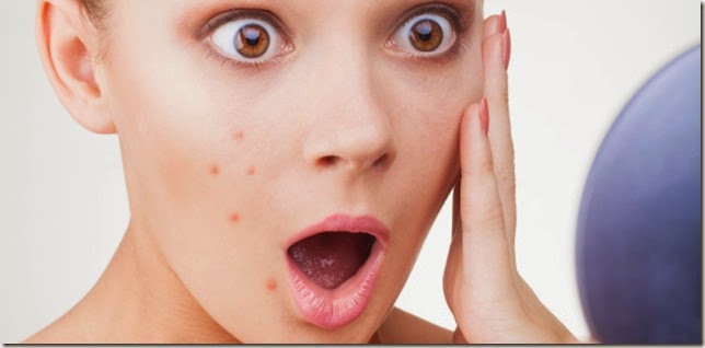How to get rid-off pimples problems