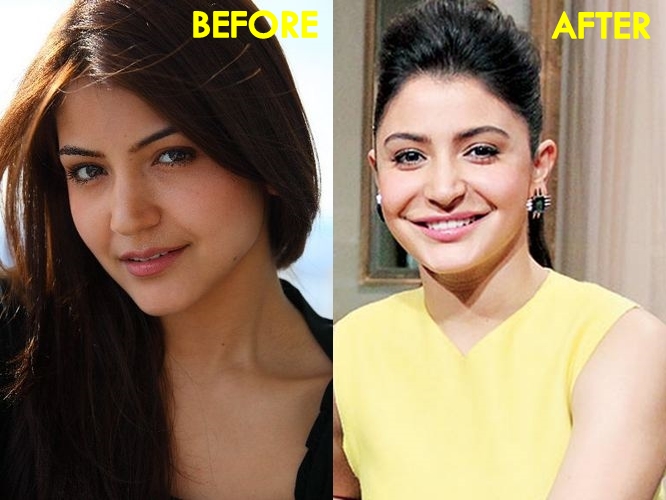 Anushka Sharma Lip Job