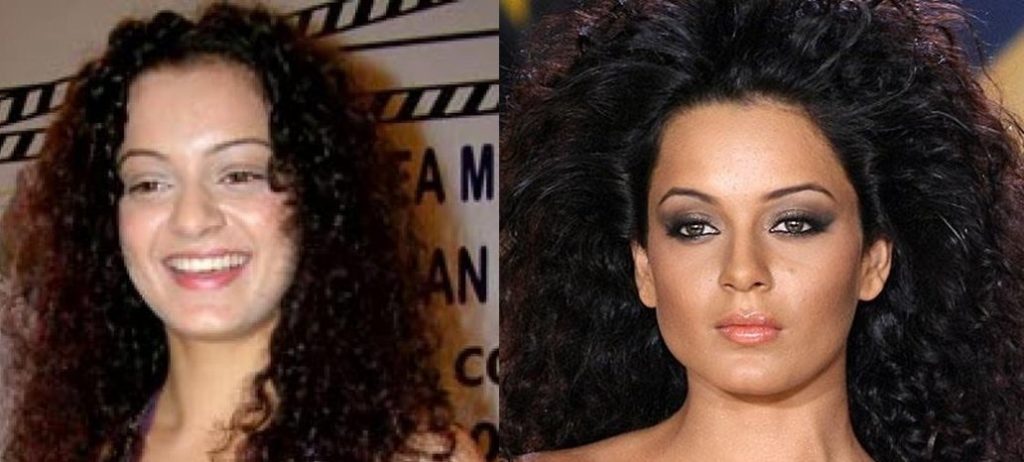 8 Bollywood Actresses Who Spoiled Their Looks After Plastic Surgery