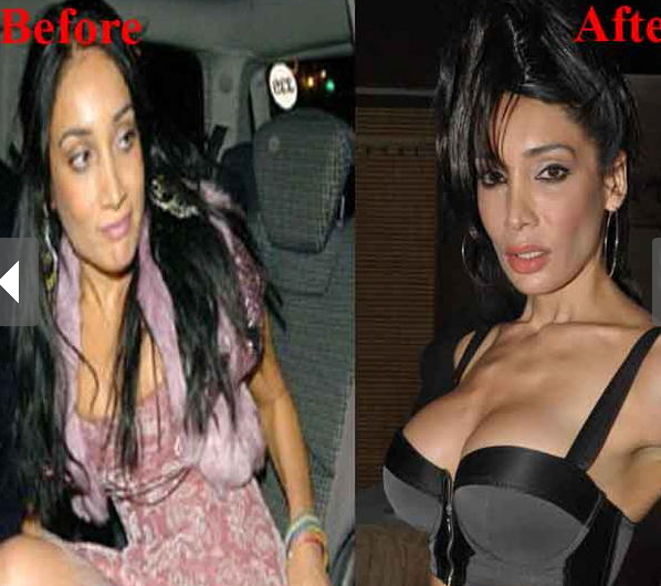 sofia-hayat-plastic-surgery-pics