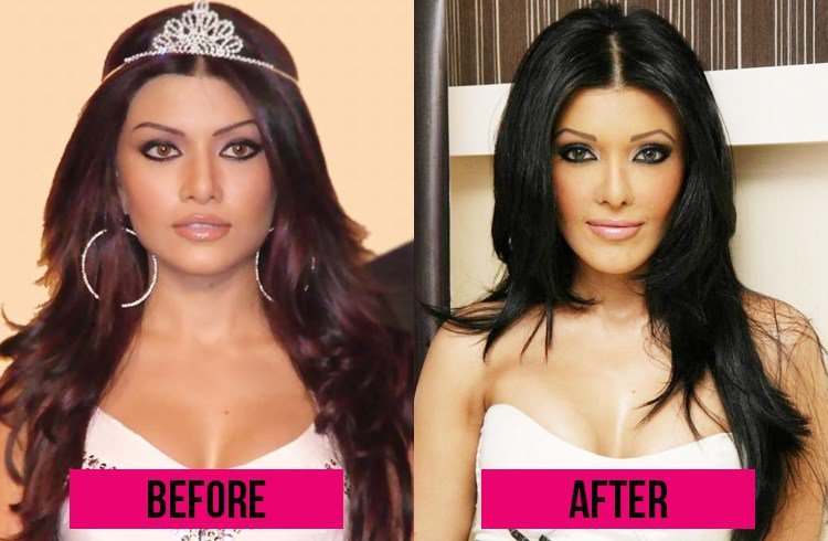 8 Bollywood Actresses Who Spoiled Their Looks After Plastic Surgery