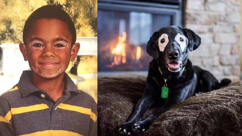 boy and dog suffering from skin disease