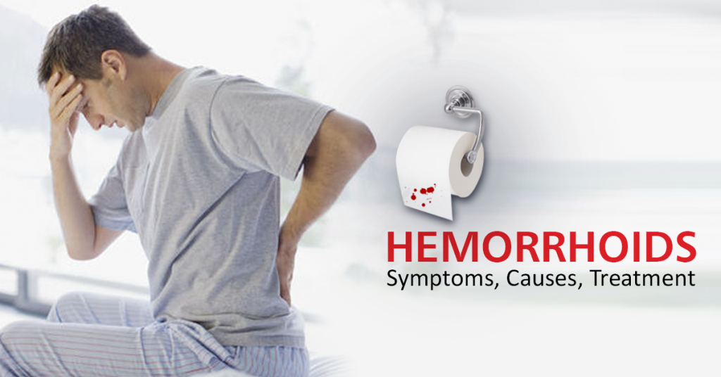 Home Remedies To Get Rid-Of Hemorrhoids